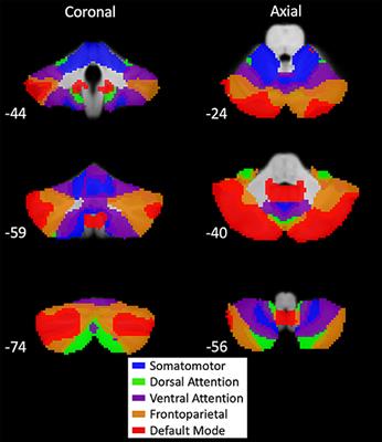 Resting-State Cerebello-Cortical Dysfunction in Parkinson's Disease